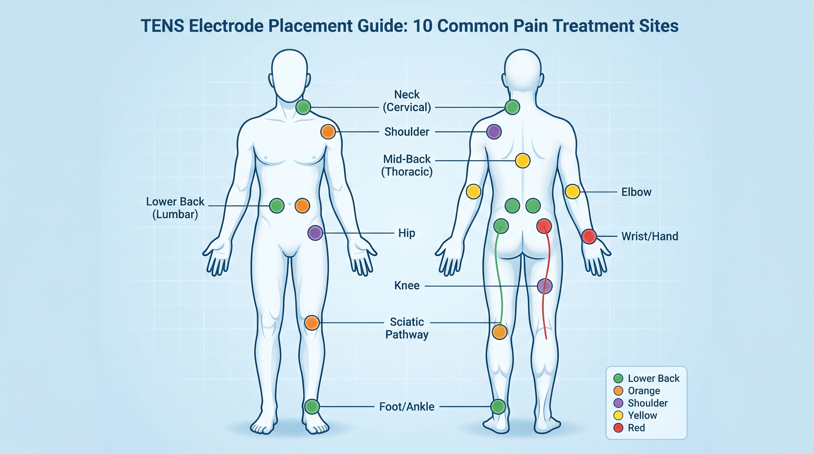 Full Body TENS Electrode Placement Chart Showing 10 Common Treatment Sites for Pain Relief