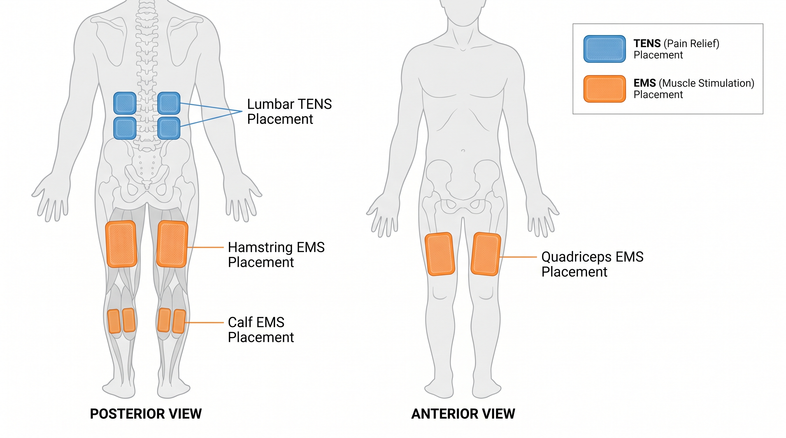 Diagram showing correct TENS and EMS electrode placement on lower back and leg muscles for weekly pain relief schedule